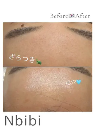 韓国🇰🇷価格 サロン_Nbibiのエステ・リラクイメージ