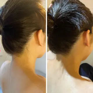 うなじ脱毛/美肌脱毛 LABELのエステ・リラクイメージ