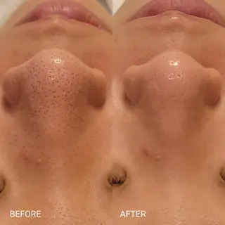 サロンドフララ 表参道店のエステ・リラクイメージ