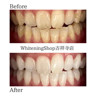 ホワイトニング ショップ吉祥寺店のエステ・リラクイメージ