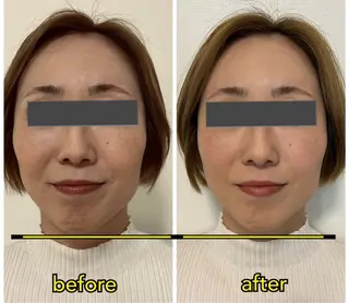 カイロプラクティックアンズ所属・カイロプラクティック アンズ（営業電話✖️のエステ・リラクイメージ