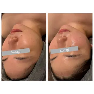 ☆痩身/小顔☆ ハイパーナイフexのエステ・リラクイメージ