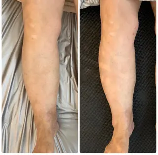 リンパとデトックス LAFUFUのエステ・リラクイメージ