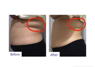 子宮矯正/腸揉み/ シュガーリング脱毛のエステ・リラクイメージ