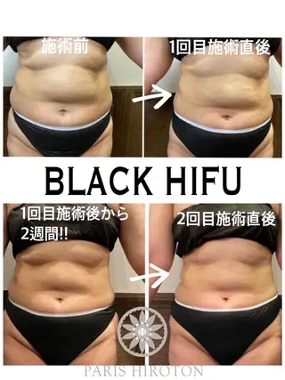 骨盤ダイエット痩身エステサロンBloom所属・坂田 真紀のエステ・リラクイメージ