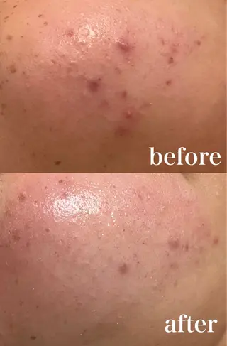 Mignon所属・mignon /栄のエステ・リラクイメージ