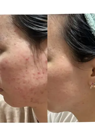 南部 杏奈のエステ・リラクイメージ