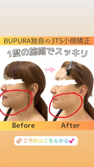小顔矯正と肌改善✨ BUPURA宇都宮店のエステ・リラクイメージ
