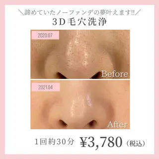 コガオファクトリー 北24条店のエステ・リラクイメージ