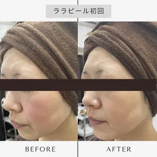 【小顔・毛穴ケア】 セラピスト　和田紋子のエステ・リラクイメージ