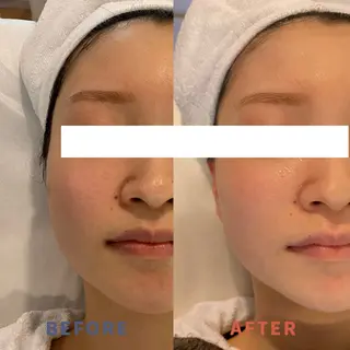 エステと焼き菓子 レモンバームソワンのエステ・リラクイメージ