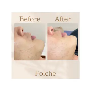 【folche】 フジイのエステ・リラクイメージ