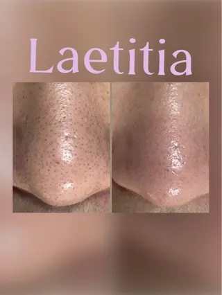 メンズ レティティア【Laetitia】所属・レティティア秋葉原店 Yoshizawaのエステ・リラクイメージ