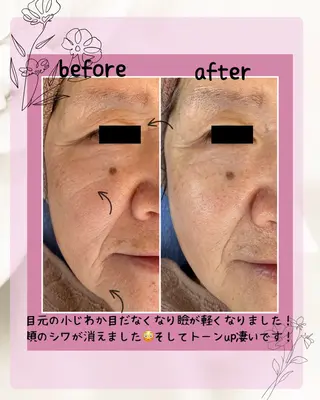 プレジール所属・ビューティサロン プレジールOTAKEのエステ・リラクイメージ