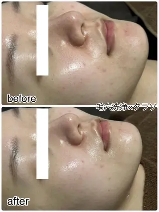 ENCHANT 脱毛.小顔.毛穴のエステ・リラクイメージ