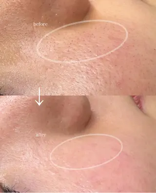 アイブロウサロン　レアファースト所属・HBLaward受賞 KANAの眉毛・アイブロウイメージ