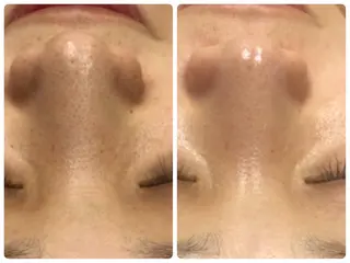 RAGU BEAUTY所属・原口 彩子のエステ・リラクイメージ