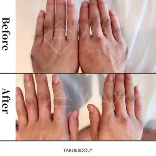 JYUNESU所属・眠れるワックス脱毛 ・銀座のエステ・リラクイメージ