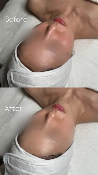 韓国肌管理🫧LDM 🫧Junnaのエステ・リラクイメージ