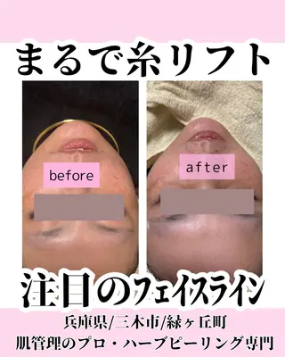 ハーブピーリング 専門／今榮麻美のエステ・リラクイメージ