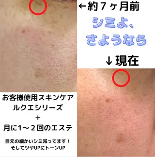 ミューズエステ 谷口美結のエステ・リラクイメージ