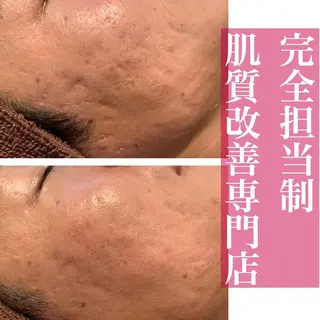 ミディアム カラー パーマ メンズ キッズ ネイル マツエク・マツパ ニキビ・肌質改善専門 ♡人生が変わるサロンのエステ・リラクイメージ