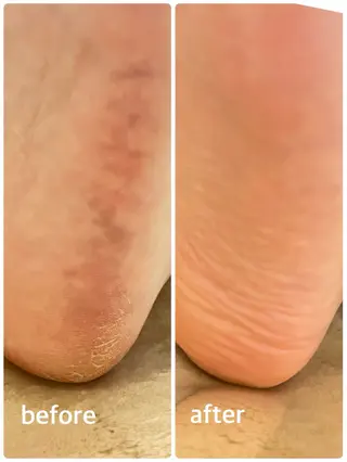 シミ・たるみ・毛穴ケア専門サロン Alluring所属・Alluring 中村のエステ・リラクイメージ