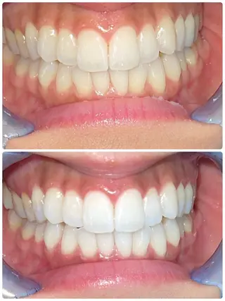 セルフホワイトニング エクシア徳島店マユのその他イメージ