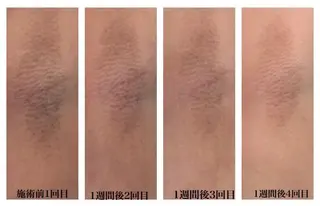 ビューティー ミロワールのエステ・リラクイメージ