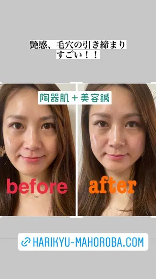 美容鍼灸サロン mahoroba院長のエステ・リラクイメージ