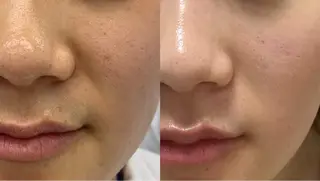 ネイル aliaハイフ&水光ジェットサロン所属・aliaハーブ水光店 エステティシャン募集のエステ・リラクイメージ