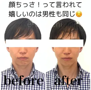 小顔と ヘッドスパのお店のエステ・リラクイメージ