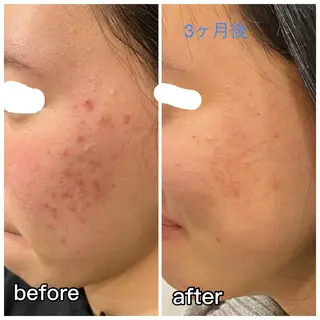 aimer beautyのエステ・リラクイメージ