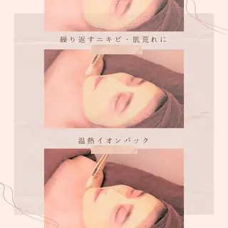 夏までに肌荒れ卒業 するサロン🌻のエステ・リラクイメージ