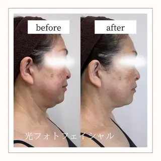 Reid-月詠-所属・Reid -月詠-のエステ・リラクイメージ