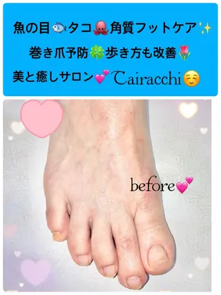 ネイル Tairacchi ﾀｲﾗｯﾁのエステ・リラクイメージ