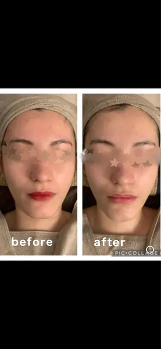 ボディ&フェイシャルサロン Vierouge所属・肌質改善・美肌サロン ヴィエルージュのエステ・リラクイメージ