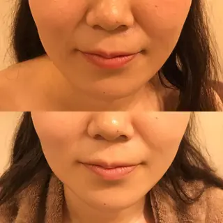 毒素出し専門サロンSylph(なかがわ整骨院併設サロン)所属・Mami Hataのエステ・リラクイメージ