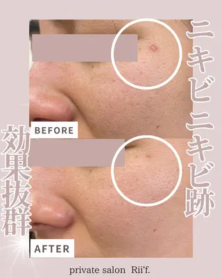 private salon Rii'f.所属・private sa lon Rii'f.のエステ・リラクイメージ