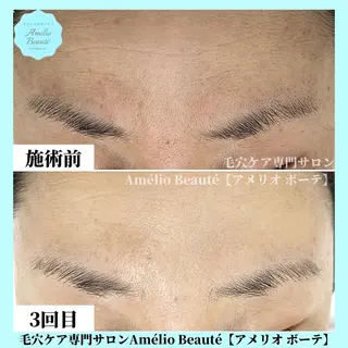 毛穴ケア専門サロン Amélio Beauté所属・毛穴ケア専門サロン アメリオボーテのその他イメージ