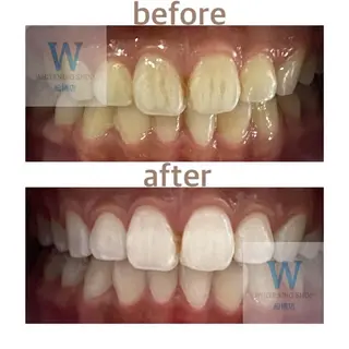 ホワイトニング ショップ船橋２号店のエステ・リラクイメージ