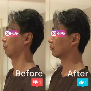 メンズ 小顔矯正&美容鍼 東洋健美のエステ・リラクイメージ