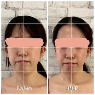 salon ace所属・【小顔矯正】 salonaceのエステ・リラクイメージ