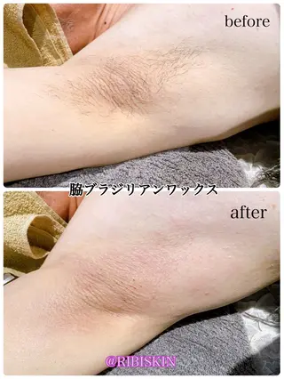 【痩身・脱毛サロン】 REBISKIN🌱のエステ・リラクイメージ