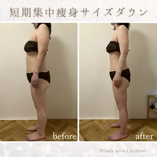 Lily branc 痩身/小顔/肌質改善のエステ・リラクイメージ