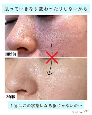 毛穴ケア専門サロン Amélio Beauté所属・毛穴ケア専門サロン アメリオボーテのその他イメージ