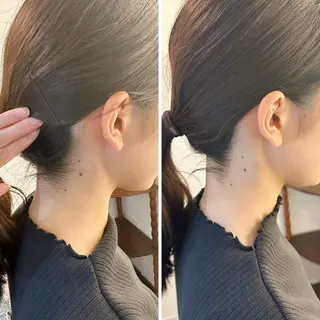 うなじ脱毛/美肌脱毛 LABELのエステ・リラクイメージ