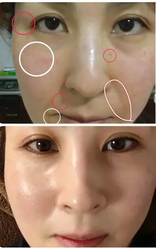 エイジングケアサロンBIOEL所属・肌質改善BIOELプ ラズマ/ラミピールのエステ・リラクイメージ