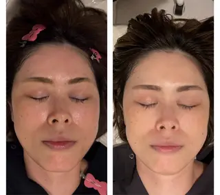 ネイル aliaハイフ&水光ジェットサロン所属・aliaハーブ水光店 エステティシャン募集のエステ・リラクイメージ