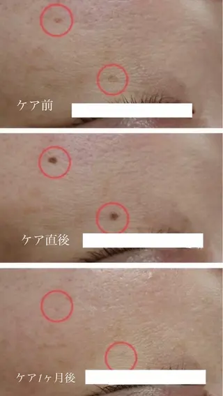 LUMY GRATiAEのエステ・リラクイメージ